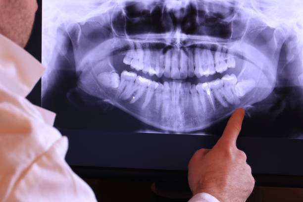 Best Emergency Treatment for Dental Infections or Abscesses in Bruceton, TN